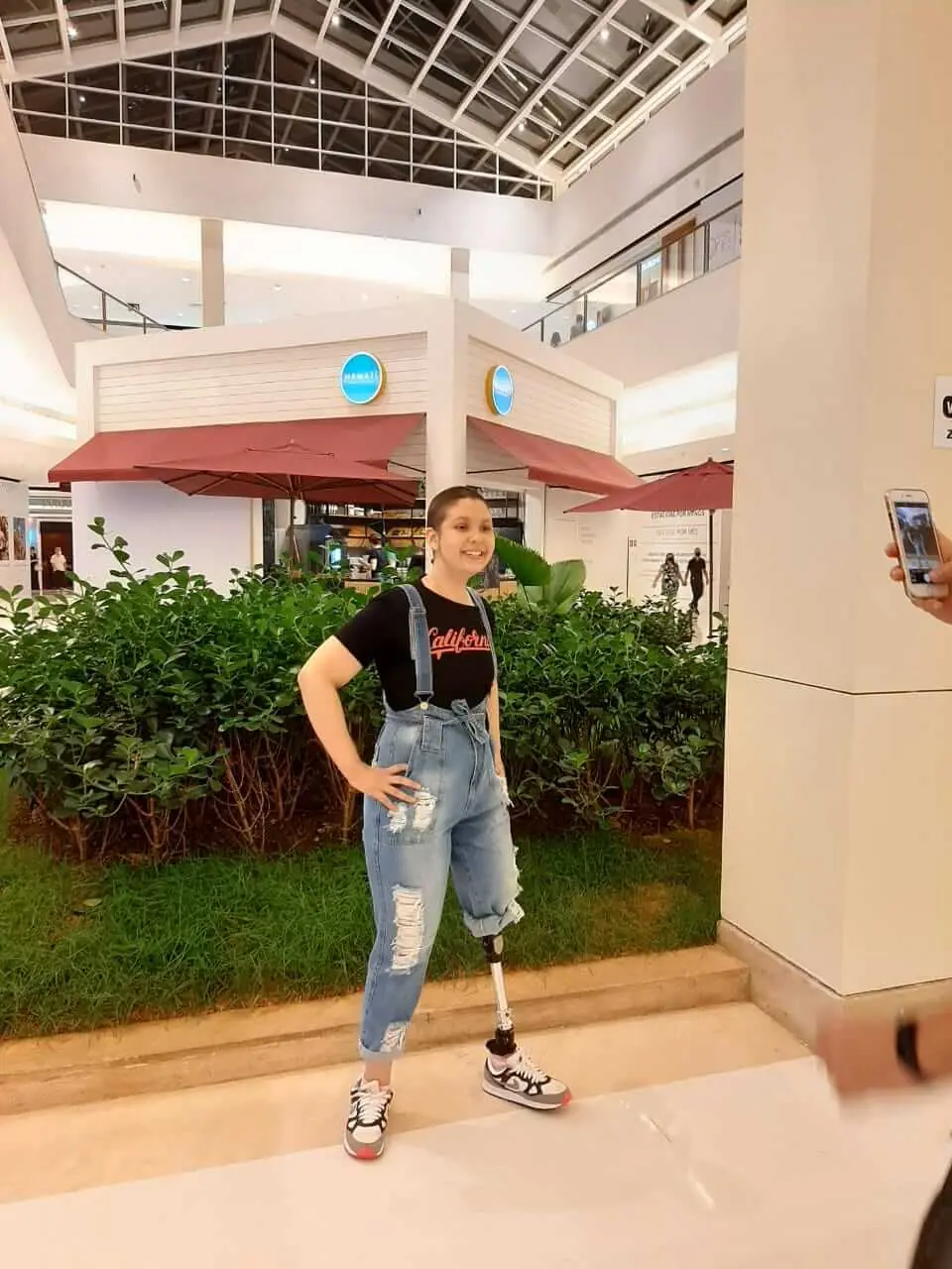Isabela Nucci: amputada aos 13 anos mostra a superação após três cirurgias, imagem 1