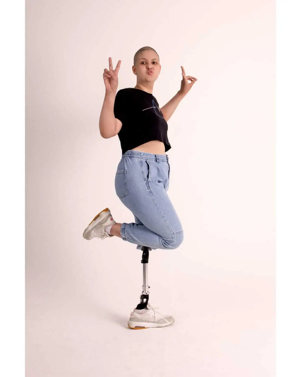 Isabela Nucci: amputada aos 13 anos mostra a superação após três cirurgias, imagem 2