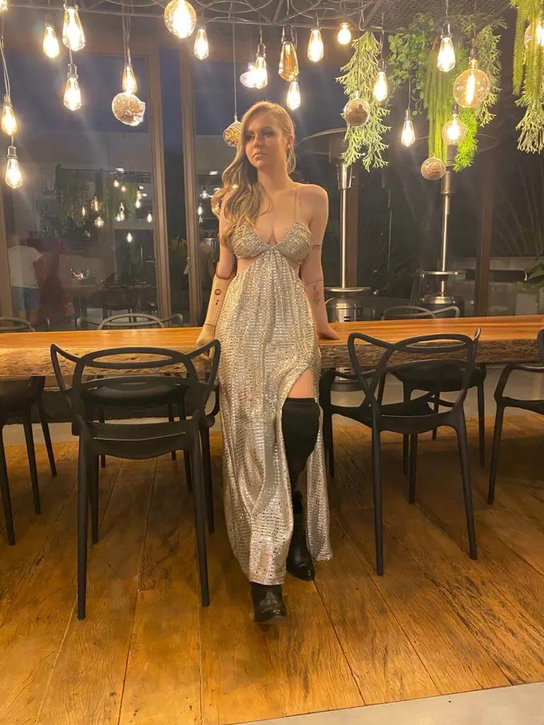 Milena Nenemann: a superação após a amputação, imagem 2