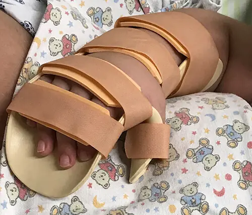 Terapia Ocupacional