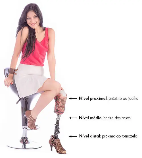 O que é Amputação Transtibial?, imagem 1