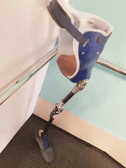 Prótese-desarticulação-de-quadril1