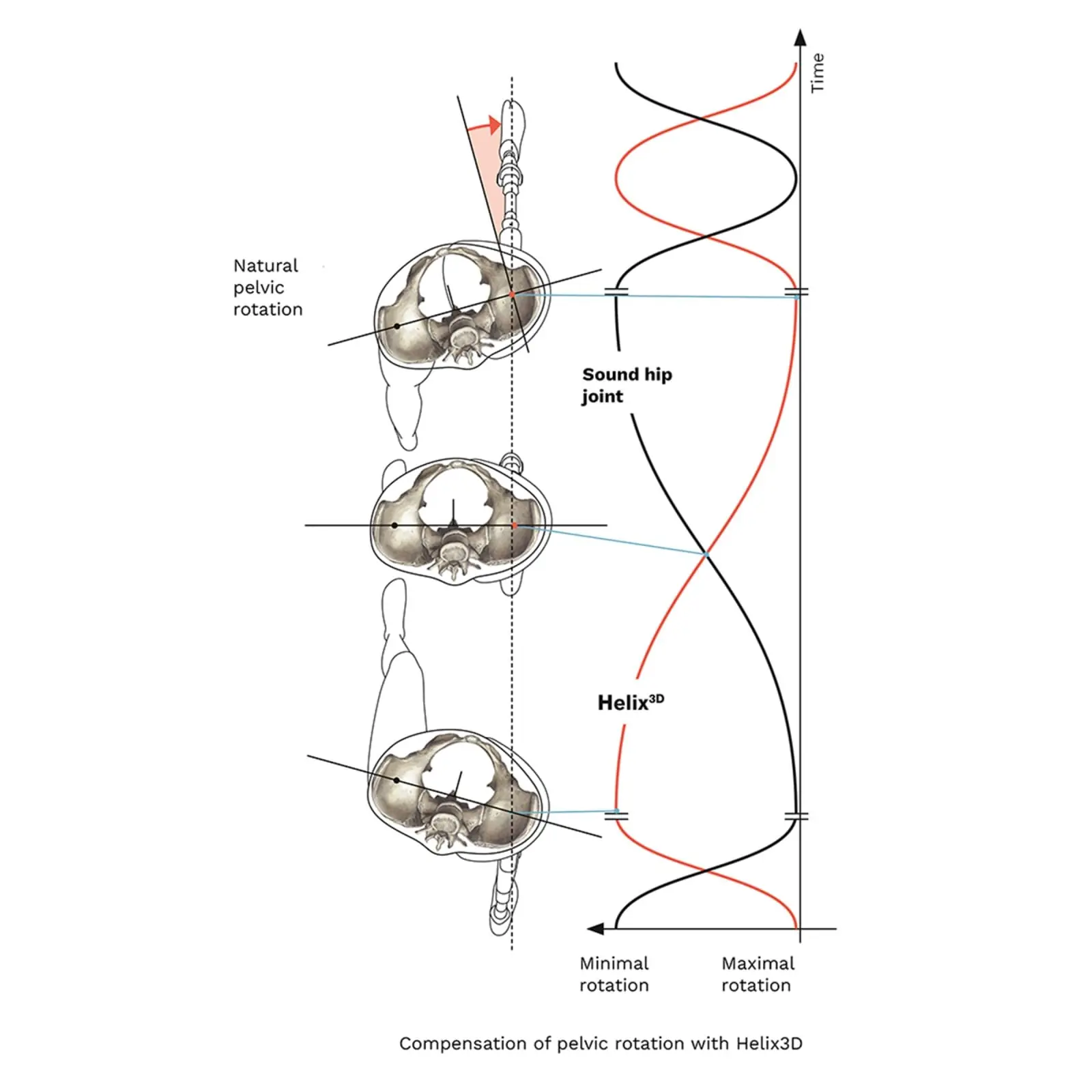 Helix3D, da Ottobock, foto 11