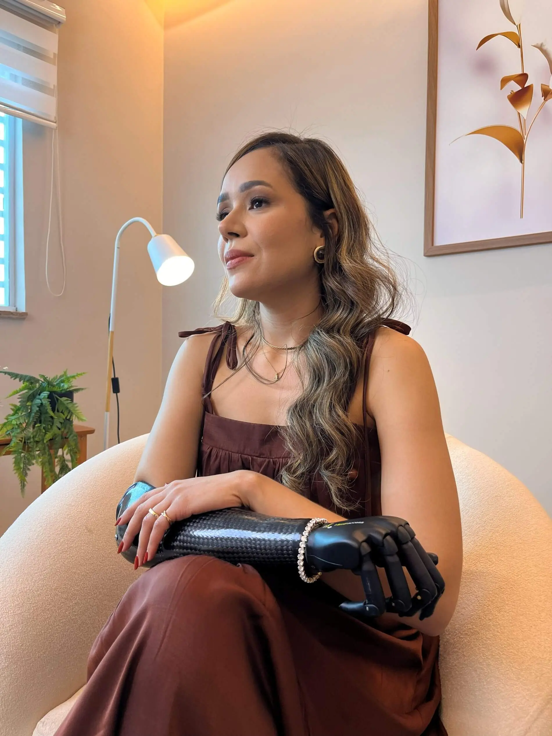 Vanessa Lisboa, paciente da Conforpés, com prótese de braço abaixo do cotovelo