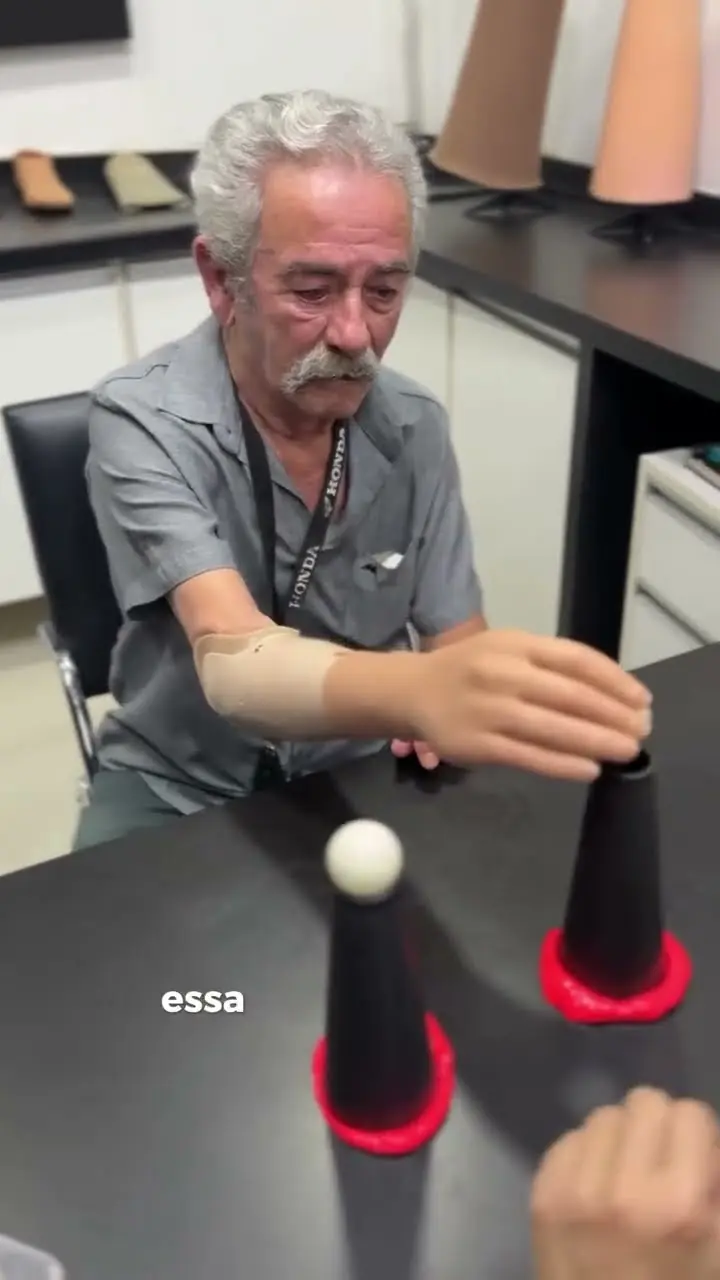 Flávio usando a mão mioelétrica