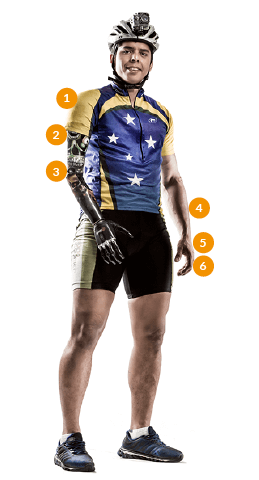 Representação dos níveis de amputação de membro superior. Paratleta Odair Costa de BMX.